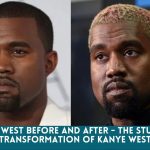 Kanye west before and after - The Stunning Transformation Of Kanye West