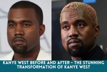 Kanye west before and after - The Stunning Transformation Of Kanye West