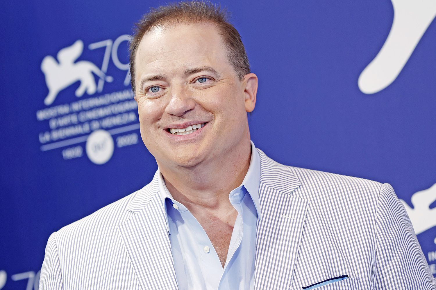 what is wrong with brendan fraser