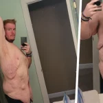 casey king weight loss