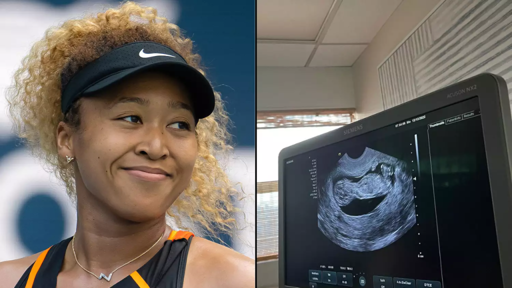 Pregnant Naomi Osaka Claims She Knew Baby's Sex but Cordae "Doesn't Know"!