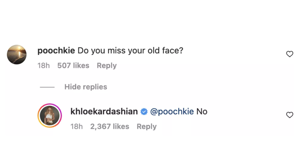 Khloé Kardashian Responds to Follower Who Asked if She 'misses' Her 'Old Face'!