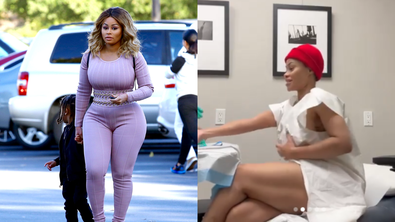 Blac Chyna Details Breast and Butt Reduction Process