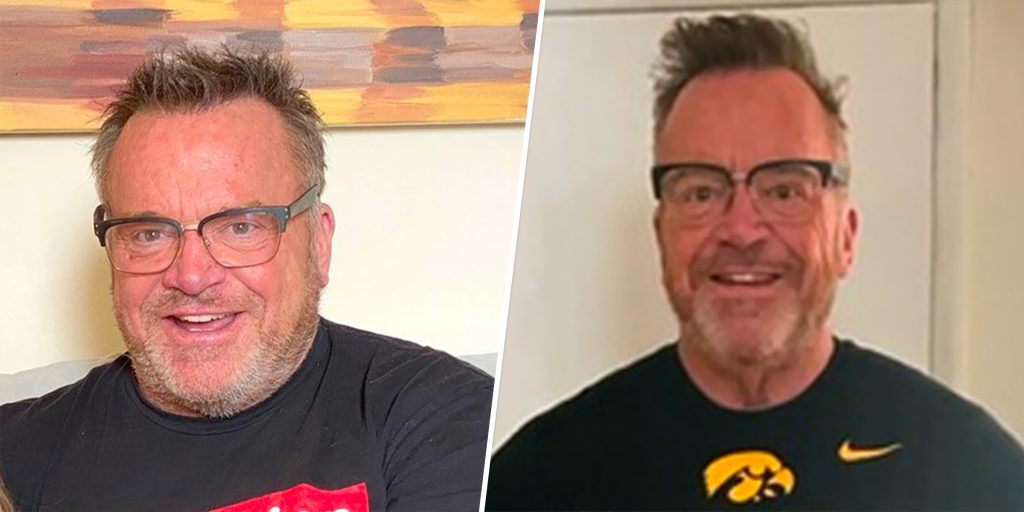 tom arnold weight loss