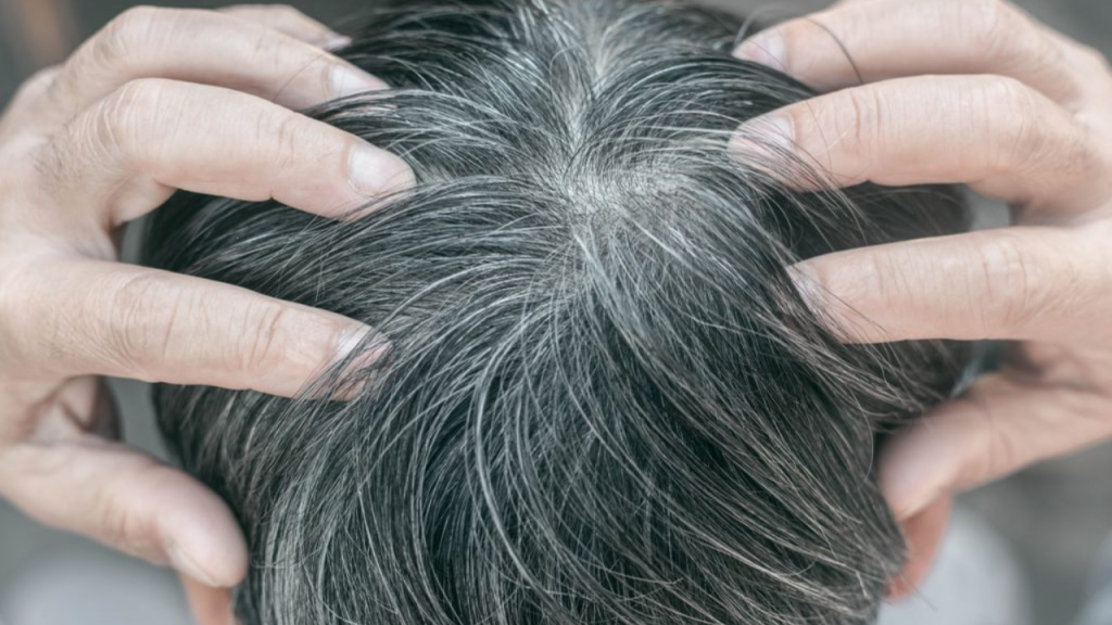 wellhealthorganic-com-know-the-causes-of-white-hair-and-easy-ways-to-prevent-it-naturally